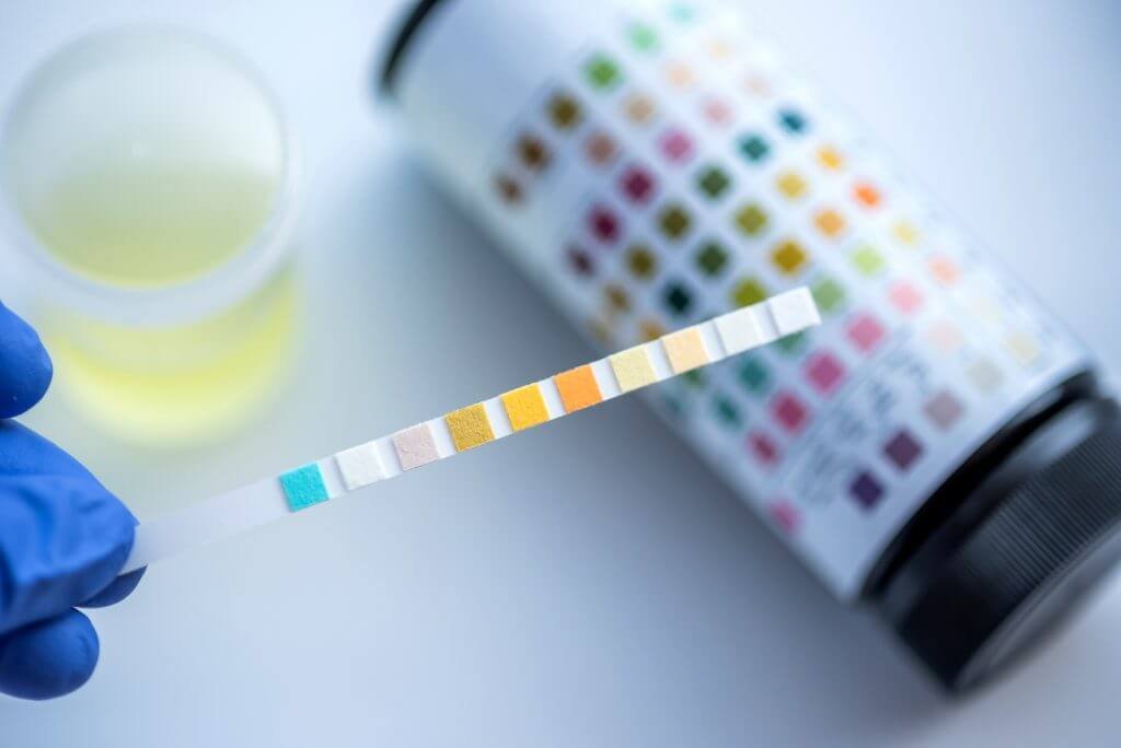 Reagent drug testing