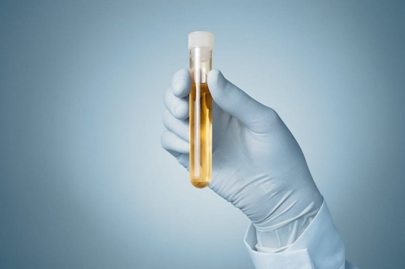Drug Testing